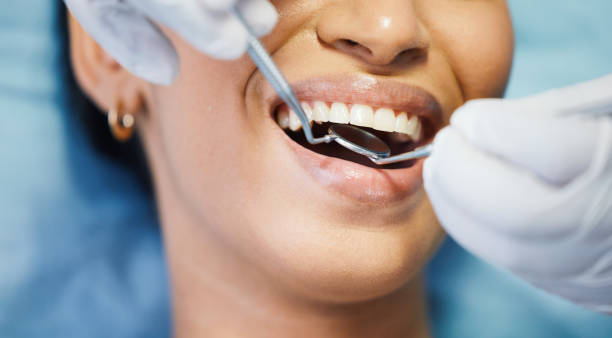 Best Emergency Dental Care for Sports Injuries in Greendale, WI